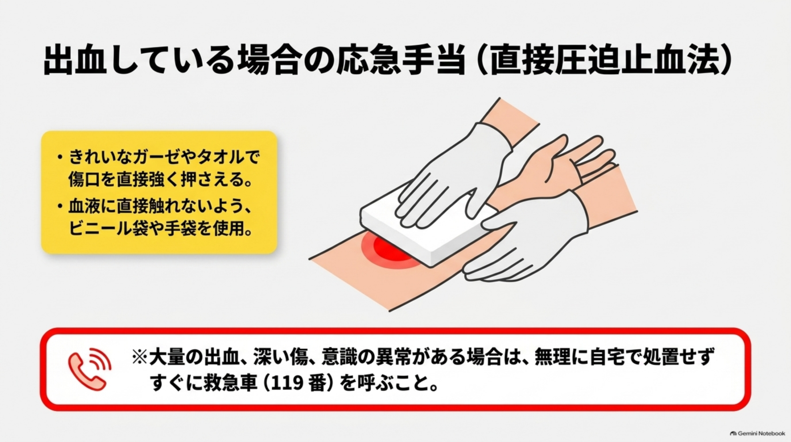 出血している場合の応急手当（直接圧迫止血法）という図解。「きれいなガーゼやタオルで傷口を直接強く押さえる」「血液に直接触れないよう、ビニール袋や手袋を使用」という2つのポイントと、白いガーゼを腕の傷口に当てて両手で押さえるイラスト。下部に赤枠で「大量の出血、深い傷、意識の異常がある場合は、無理に自宅で処置せずすぐに救急車（119番）を呼ぶこと」という警告文